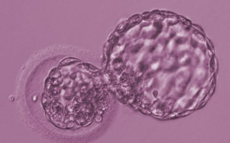 Почему происходит остановка развития эмбрионов? фото 81